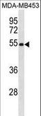 Eukaryotic Translation Initiation Factor 2 Subunit Beta antibody, LS-C157707, Lifespan Biosciences, Western Blot image 