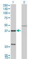 Cathepsin K antibody, LS-B4308, Lifespan Biosciences, Western Blot image 