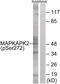 MAPK Activated Protein Kinase 2 antibody, 79-915, ProSci, Western Blot image 