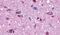 Melanin Concentrating Hormone Receptor 1 antibody, PA5-33932, Invitrogen Antibodies, Immunohistochemistry frozen image 