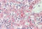 Coagulation Factor XIII B Chain antibody, ARP41999_P050, Aviva Systems Biology, Immunohistochemistry frozen image 