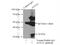 Annexin A3 antibody, 11804-1-AP, Proteintech Group, Immunoprecipitation image 