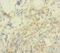 SWI/SNF Related, Matrix Associated, Actin Dependent Regulator Of Chromatin, Subfamily A, Member 2 antibody, LS-C370344, Lifespan Biosciences, Immunohistochemistry paraffin image 