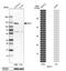 BicC Family RNA Binding Protein 1 antibody, NBP1-94171, Novus Biologicals, Western Blot image 