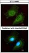 Aldo-Keto Reductase Family 1 Member B10 antibody, GTX116651, GeneTex, Immunofluorescence image 