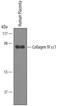 Collagen Type IV Alpha 1 Chain antibody, AF6308, R&D Systems, Western Blot image 
