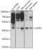 Somatostatin Receptor 3 antibody, 16-412, ProSci, Western Blot image 