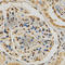Egl-9 Family Hypoxia Inducible Factor 1 antibody, A1151, ABclonal Technology, Immunohistochemistry paraffin image 