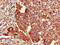 GluRS antibody, LS-C677753, Lifespan Biosciences, Immunohistochemistry paraffin image 