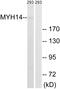 Myosin Heavy Chain 14 antibody, GTX87578, GeneTex, Western Blot image 