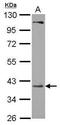 Phosphoribosyl Pyrophosphate Synthetase Associated Protein 2 antibody, PA5-31237, Invitrogen Antibodies, Western Blot image 