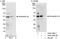 SH3 Domain Containing GRB2 Like 1, Endophilin A2 antibody, A302-349A, Bethyl Labs, Western Blot image 