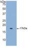 Activin A Receptor Type 1 antibody, LS-C708760, Lifespan Biosciences, Western Blot image 