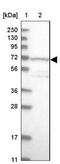 Tudor and KH domain-containing protein antibody, NBP1-80697, Novus Biologicals, Western Blot image 