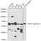 Cytochrome B-245 Beta Chain antibody, GTX00785, GeneTex, Western Blot image 