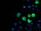 IlvB Acetolactate Synthase Like antibody, M15029, Boster Biological Technology, Immunofluorescence image 