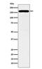 Diaphanous Related Formin 1 antibody, M02308-1, Boster Biological Technology, Western Blot image 