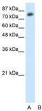 TSC22 Domain Family Member 2 antibody, TA343752, Origene, Western Blot image 