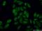 E3 ubiquitin-protein ligase RBBP6 antibody, 11882-1-AP, Proteintech Group, Immunofluorescence image 