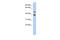 Suppressor Of Cytokine Signaling 7 antibody, PA5-44102, Invitrogen Antibodies, Western Blot image 