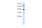 TOX High Mobility Group Box Family Member 2 antibody, PA5-40307, Invitrogen Antibodies, Western Blot image 