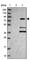 Kelch Repeat And BTB Domain Containing 7 antibody, HPA043709, Atlas Antibodies, Western Blot image 