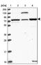 ER Degradation Enhancing Alpha-Mannosidase Like Protein 2 antibody, PA5-61720, Invitrogen Antibodies, Western Blot image 