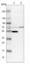 Lactamase Beta antibody, NBP1-91701, Novus Biologicals, Western Blot image 