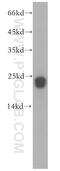 Nuclear Receptor Coactivator 3 antibody, 16117-1-AP, Proteintech Group, Western Blot image 