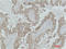 Mitogen-Activated Protein Kinase Kinase 2 antibody, STJ97451, St John