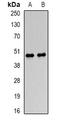 DNA Nucleotidylexotransferase antibody, orb378037, Biorbyt, Western Blot image 