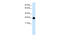 Tyrosine 3-Monooxygenase/Tryptophan 5-Monooxygenase Activation Protein Eta antibody, 31-025, ProSci, Enzyme Linked Immunosorbent Assay image 