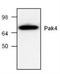P21 (RAC1) Activated Kinase 4 antibody, NBP1-45763, Novus Biologicals, Western Blot image 