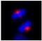 Centrosomal Protein 170 antibody, NB100-55317, Novus Biologicals, Immunofluorescence image 