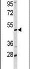 Decapping MRNA 2 antibody, PA5-26190, Invitrogen Antibodies, Western Blot image 