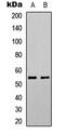 Serum/Glucocorticoid Regulated Kinase 1 antibody, GTX55032, GeneTex, Western Blot image 