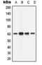 Calcium/Calmodulin Dependent Protein Kinase II Beta antibody, orb213634, Biorbyt, Western Blot image 