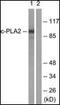 Phospholipase A2 Group IVA antibody, orb95922, Biorbyt, Western Blot image 