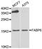 Fatty Acid Binding Protein 6 antibody, PA5-77060, Invitrogen Antibodies, Western Blot image 