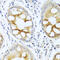 Protein Kinase C Alpha antibody, 13-116, ProSci, Immunohistochemistry frozen image 