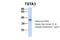 Tissue Specific Transplantation Antigen P35B antibody, NBP1-59130, Novus Biologicals, Western Blot image 