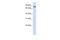 Lpap antibody, A10195, Boster Biological Technology, Western Blot image 