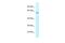 Hyaluronan Binding Protein 2 antibody, PA5-70038, Invitrogen Antibodies, Western Blot image 