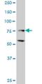 Zinc Finger E-Box Binding Homeobox 2 antibody, H00009839-M03, Novus Biologicals, Western Blot image 