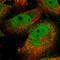 Zinc Finger Protein 776 antibody, HPA046653, Atlas Antibodies, Immunofluorescence image 