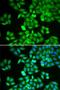 Rho GDP Dissociation Inhibitor Alpha antibody, orb538483, Biorbyt, Immunofluorescence image 