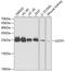 Glutathione S-Transferase Pi 1 antibody, A5691, ABclonal Technology, Western Blot image 