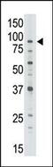 ATP Binding Cassette Subfamily B Member 7 antibody, 62-131, ProSci, Western Blot image 