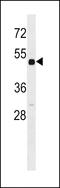 Retinoic Acid Receptor Beta antibody, LS-C162445, Lifespan Biosciences, Western Blot image 