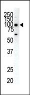 EPH Receptor A1 antibody, 63-037, ProSci, Western Blot image 